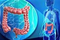 برنامه آموزشی سرطان کولورکتال